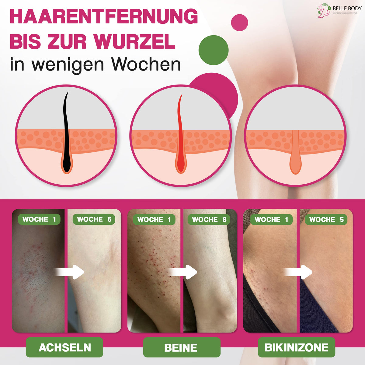 VELUNA™ | IPL Haarentferner