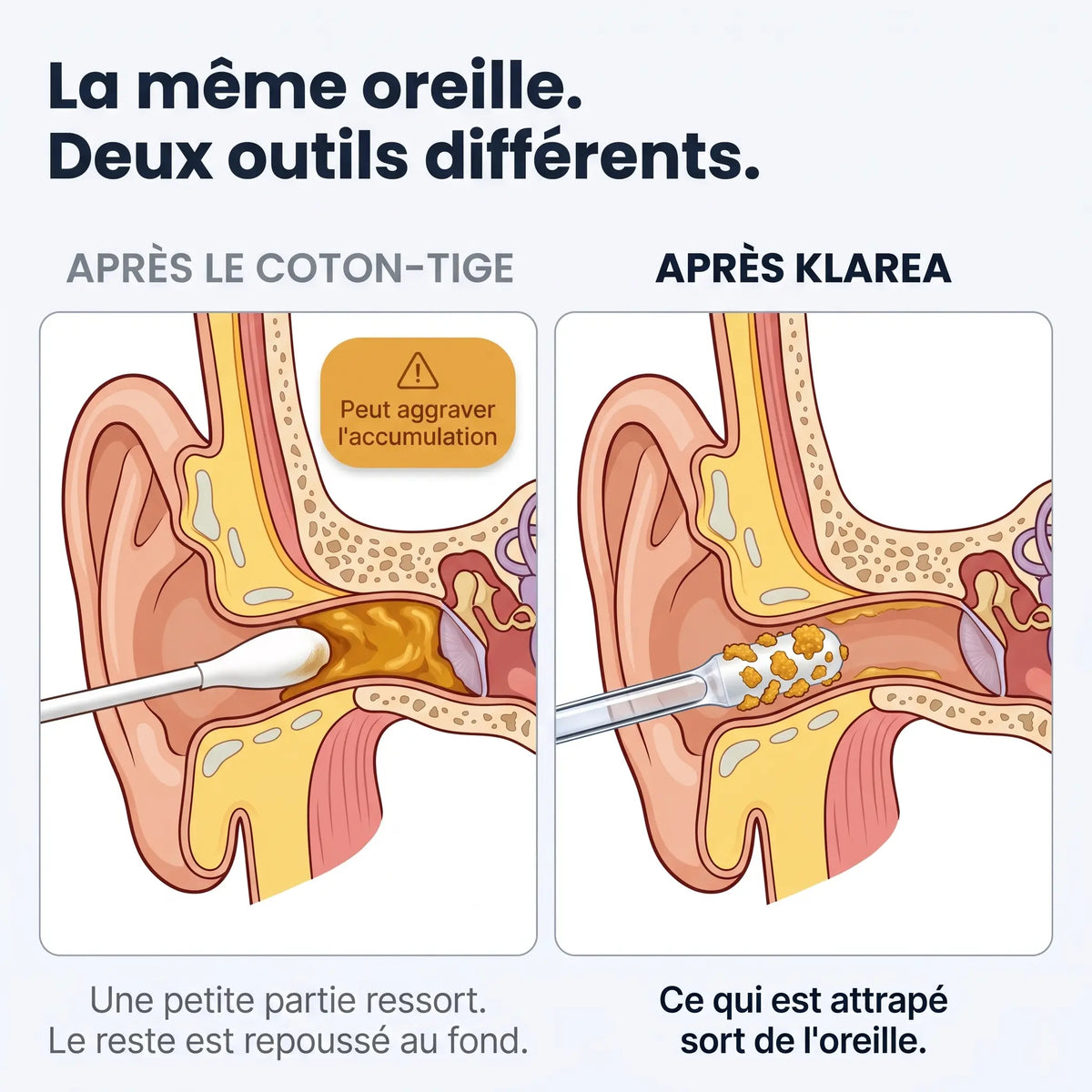 Ohriva™ – Für ein wirklich sauberes Gefühl im Ohr